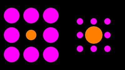 Susceptibility to geometrical visual illusions in Parkinson’s disorder